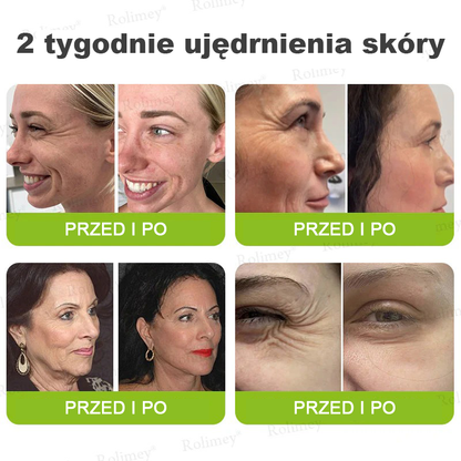 👨‍⚕️🇺🇸Najnowocześniejsze amerykańskie osiągnięcie w walce z oznakami starzenia ✅ Rolimey® krem przeciwzmarszczkowy z botoksem i retinolem Vita-A – Ostatni dzień promocji, 70% TANIEJ⏰