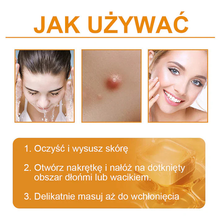 【✨Za pobraniem✨】Vsoxa™ Krem do usuwania brodawek i pieprzyków z jadem pszczelim (👨‍⚕Zalecenia AAD) 🐝🐝 (🔥Ostatni dzień wyprzedaży 70% taniej)