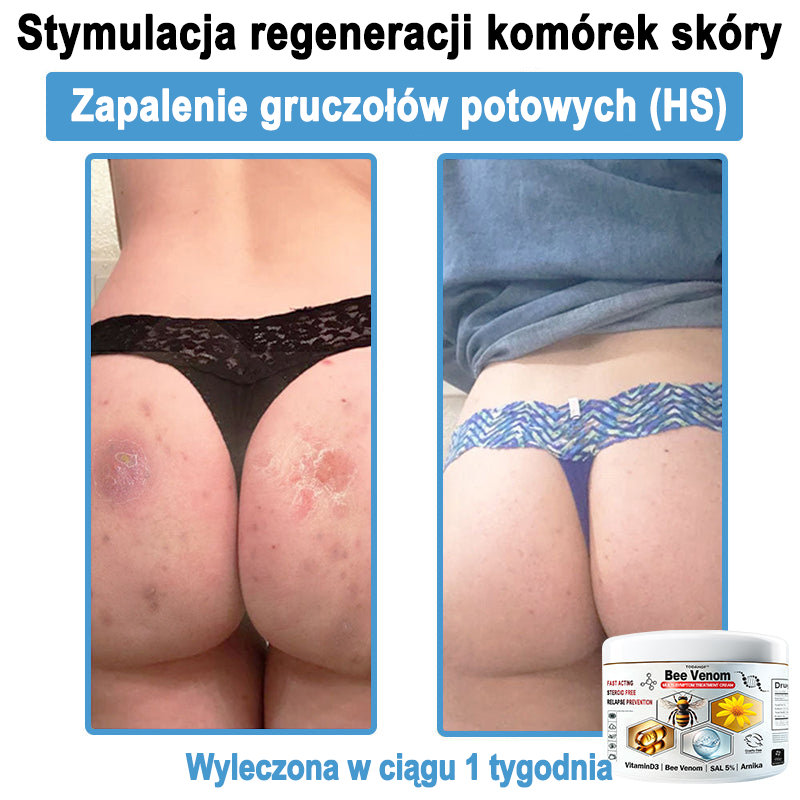 TOD𝐀HOF™🥑 Krem do wielosymptomowej pielęgnacji skóry z jadem pszczelim (ACDRECOMMENDS)