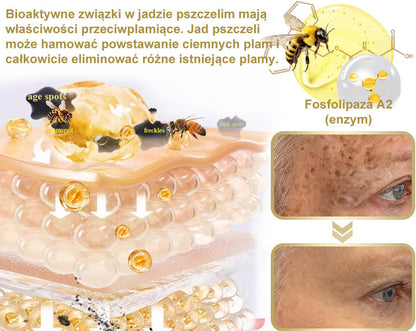 Gotówka przy odbiorze] flysmus™ Bee Venom Wart and Mole Removal Skin Cream (👨‍⚕Zalecenia AAD) 🐝🐝 (🔥Ostatni dzień promocji 70% taniej)