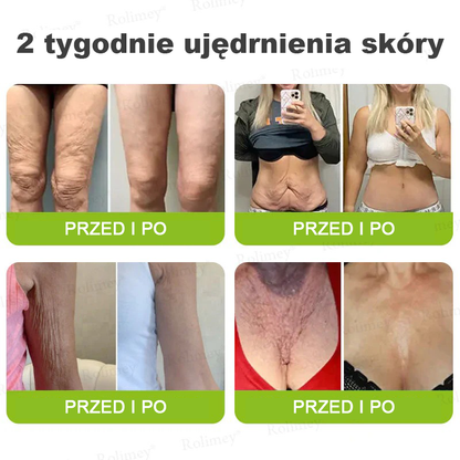 👨‍⚕️🇺🇸Najnowocześniejsze amerykańskie osiągnięcie w walce z oznakami starzenia ✅ Rolimey® krem przeciwzmarszczkowy z botoksem i retinolem Vita-A – Ostatni dzień promocji, 70% TANIEJ⏰