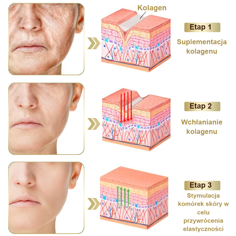 Gotówka przy odbiorze] flysmus™ Bee Venom Wart and Mole Removal Skin Cream (👨‍⚕Zalecenia AAD) 🐝🐝 (🔥Ostatni dzień promocji 70% taniej)