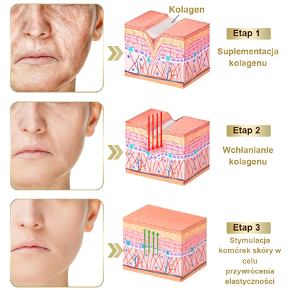 Gotówka przy odbiorze] flysmus™ Bee Venom Wart and Mole Removal Skin Cream (👨‍⚕Zalecenia AAD) 🐝🐝 (🔥Ostatni dzień promocji 70% taniej)