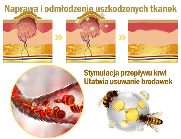 Gotówka przy odbiorze] flysmus™ Bee Venom Wart and Mole Removal Skin Cream (👨‍⚕Zalecenia AAD) 🐝🐝 (🔥Ostatni dzień promocji 70% taniej)