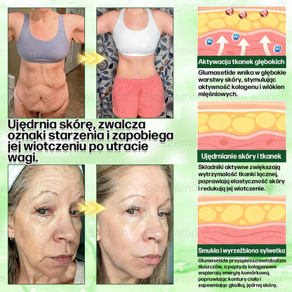 🐝Oficjalny Sklep | 👩‍⚕️🎁 𝐆𝐞𝑒𝐿𝑒𝐦𝐨𝐧® 𝐆𝐥𝐮𝐦ase𝐭𝐢𝐝𝐞 𝟖 𝐰 𝟏 Smukły i Zdrowy Nano Plaster z Mikronakłuciami 🇵🇱(Tylko raz dziennie, widoczne zmiany już w 7 dni)✅ Na otyłość, wiotką skórę, cukrzycę, bezdech senny, problemy ze stawami i wiele więcej