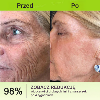 👨‍⚕️🇺🇸Najnowocześniejsze amerykańskie osiągnięcie w walce z oznakami starzenia ✅ Rolimey® krem przeciwzmarszczkowy z botoksem i retinolem Vita-A – Ostatni dzień promocji, 70% TANIEJ⏰