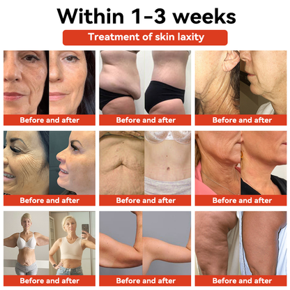 STDIE™ Magiczny luksusowy olejek do ciała ( Ograniczona oferta czasowa – 80% zniżki – ostatnie 30 minut)🌹🔥