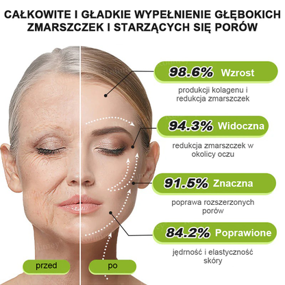 👨‍⚕️🇺🇸Najnowocześniejsze amerykańskie osiągnięcie w walce z oznakami starzenia ✅ Rolimey® krem przeciwzmarszczkowy z botoksem i retinolem Vita-A – Ostatni dzień promocji, 70% TANIEJ⏰