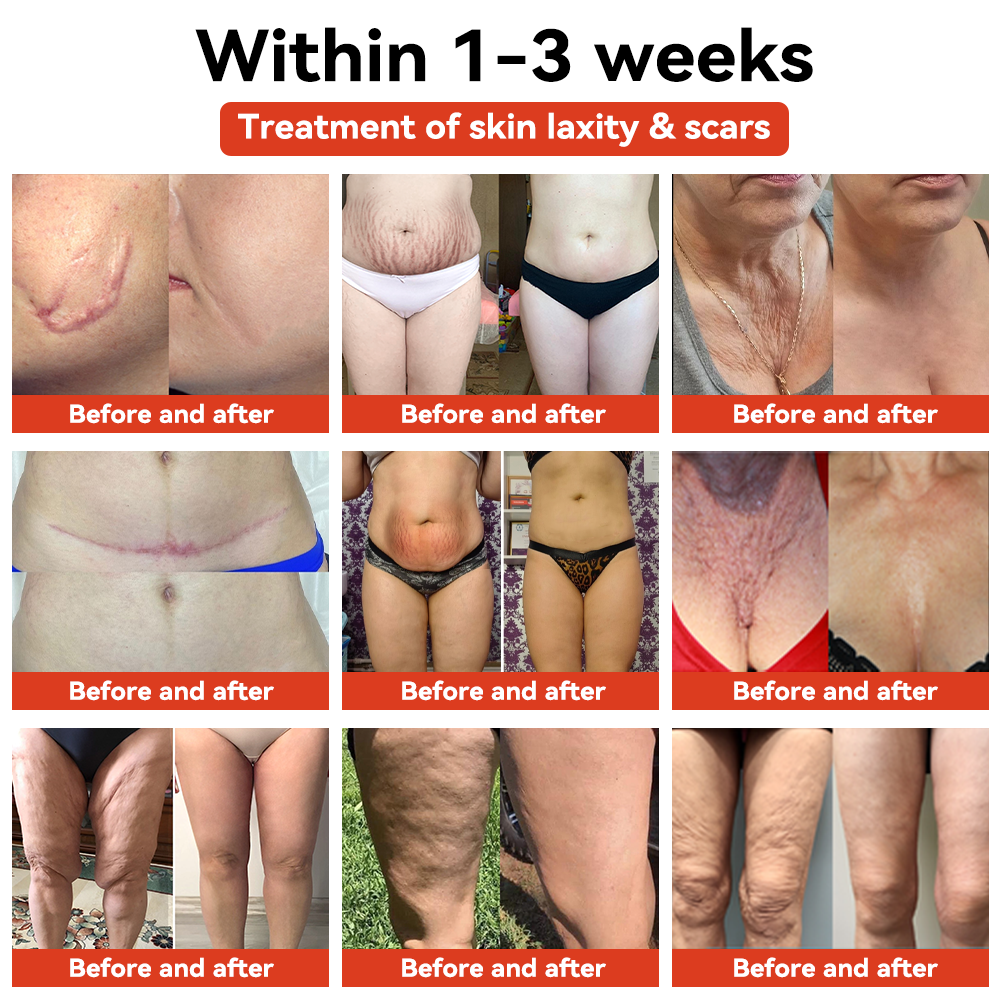 STDIE™ Magiczny luksusowy olejek do ciała ( Ograniczona oferta czasowa – 80% zniżki – ostatnie 30 minut)🌹🔥