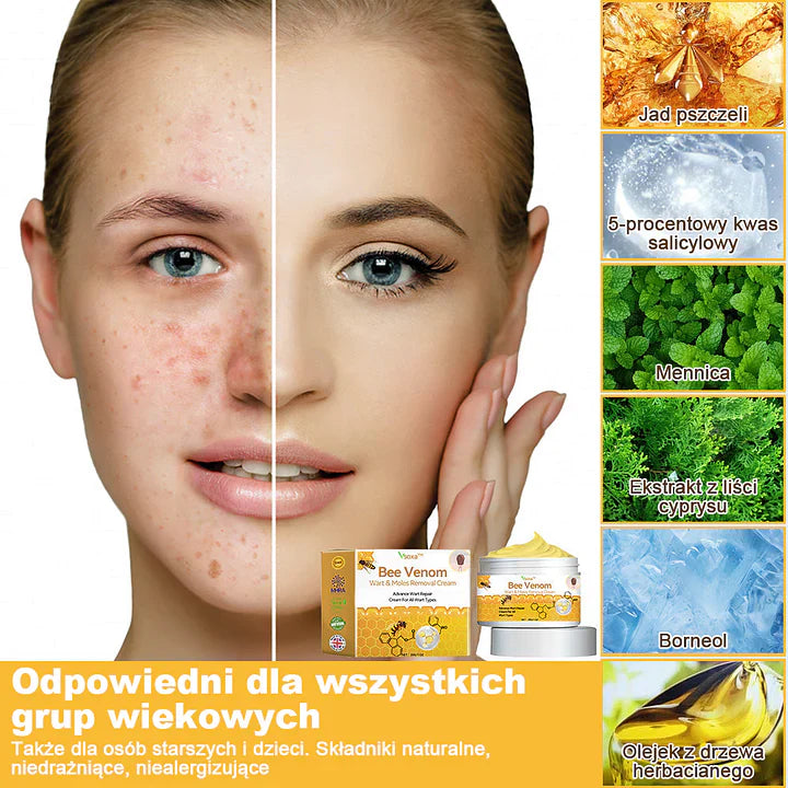 【✨Za pobraniem✨】Vsoxa™ Krem do usuwania brodawek i pieprzyków z jadem pszczelim (👨‍⚕Zalecenia AAD) 🐝🐝 (🔥Ostatni dzień wyprzedaży 70% taniej)
