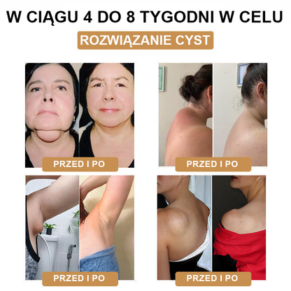 【🫧Płatność przy odbiorze🫧】Nowa bransoletka detoksykująca do liposukcji ultradźwiękowej SlimPulse™ 2024 (zalecana przez lekarza👨‍⚕)