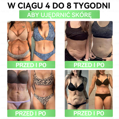 🐝Oficjalny Sklep | 👩‍⚕️🎁 𝐆𝐞𝑒𝐿𝑒𝐦𝐨𝐧® 𝐆𝐥𝐮𝐦ase𝐭𝐢𝐝𝐞 𝟖 𝐰 𝟏 Smukły i Zdrowy Nano Plaster z Mikronakłuciami 🇵🇱(Tylko raz dziennie, widoczne zmiany już w 7 dni)✅ Na otyłość, wiotką skórę, cukrzycę, bezdech senny, problemy ze stawami i wiele więcej