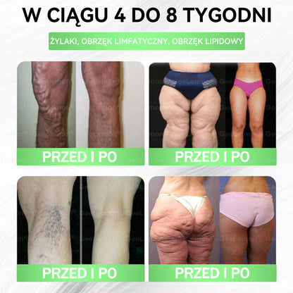 🐝Oficjalny Sklep | 👩‍⚕️🎁 𝐆𝐞𝑒𝐿𝑒𝐦𝐨𝐧® 𝐆𝐥𝐮𝐦ase𝐭𝐢𝐝𝐞 𝟖 𝐰 𝟏 Smukły i Zdrowy Nano Plaster z Mikronakłuciami 🇵🇱(Tylko raz dziennie, widoczne zmiany już w 7 dni)✅ Na otyłość, wiotką skórę, cukrzycę, bezdech senny, problemy ze stawami i wiele więcej