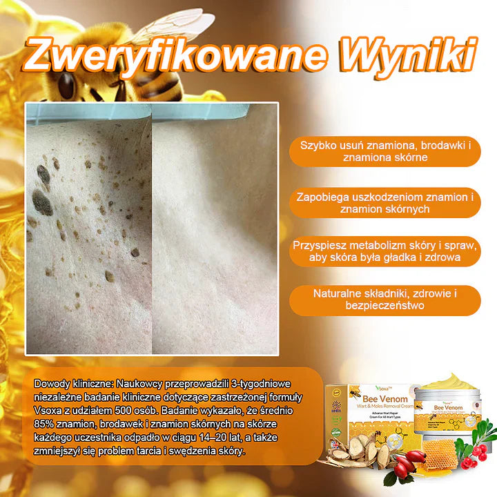 【✨Za pobraniem✨】Vsoxa™ Krem do usuwania brodawek i pieprzyków z jadem pszczelim (👨‍⚕Zalecenia AAD) 🐝🐝 (🔥Ostatni dzień wyprzedaży 70% taniej)