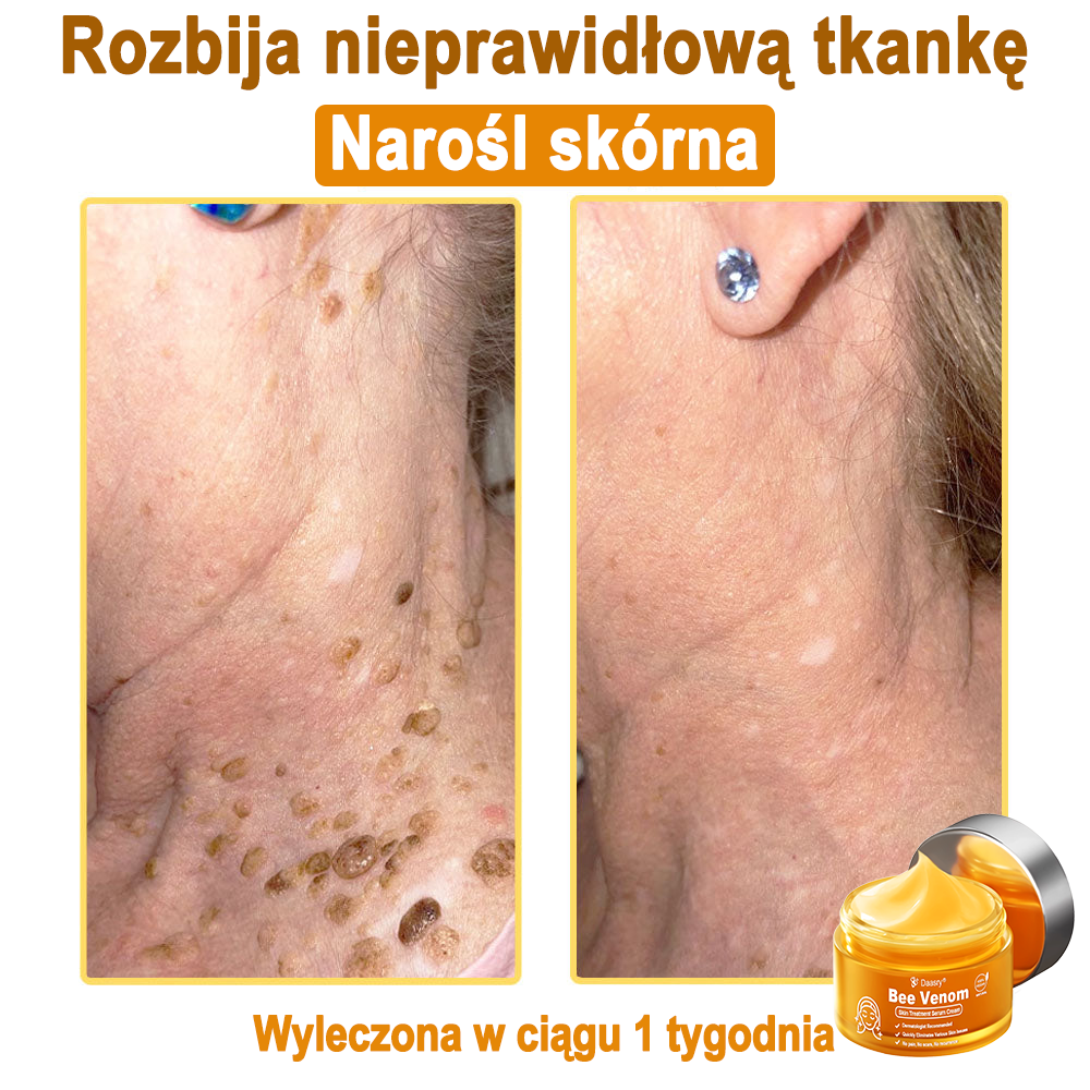 Daasry® 𝑩𝒆𝒆 𝑽𝒆𝒏𝒐𝒎 𝑺𝒌𝒊𝒏 𝑻𝒓𝒆𝒂𝒕𝒎𝒆𝒏𝒕 𝑺𝒆𝒓𝒖𝒎 𝑪𝒓𝒆𝒂𝒎👨‍⚕️ (Suitable for all ages & TGA recommends)