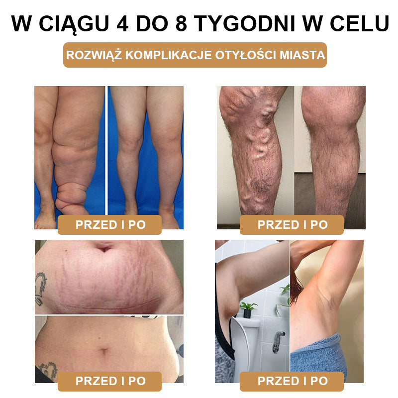 【🫧Płatność przy odbiorze🫧】Nowa bransoletka detoksykująca do liposukcji ultradźwiękowej SlimPulse™ 2024 (zalecana przez lekarza👨‍⚕)
