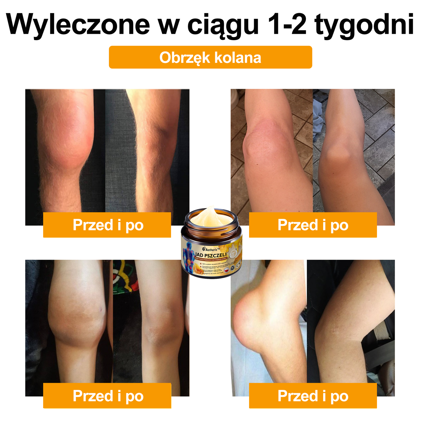 Oficjalny sklep: Aetheris™ Krem terapeutyczny z jadem pszczelim na natychmiastową, ultra silną ulgę w bólu - (Zapewnia eliminację bólu przy zapaleniu stawów, bólach mięśni, pleców, kolan, ramion, bioder, nadgarstków, dłoni)