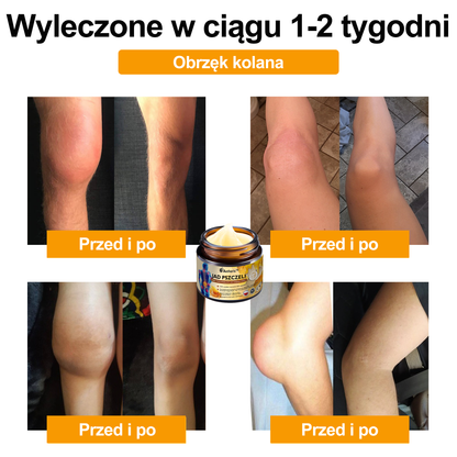 Oficjalny sklep: Aetheris™ Krem terapeutyczny z jadem pszczelim na natychmiastową, ultra silną ulgę w bólu - (Zapewnia eliminację bólu przy zapaleniu stawów, bólach mięśni, pleców, kolan, ramion, bioder, nadgarstków, dłoni)