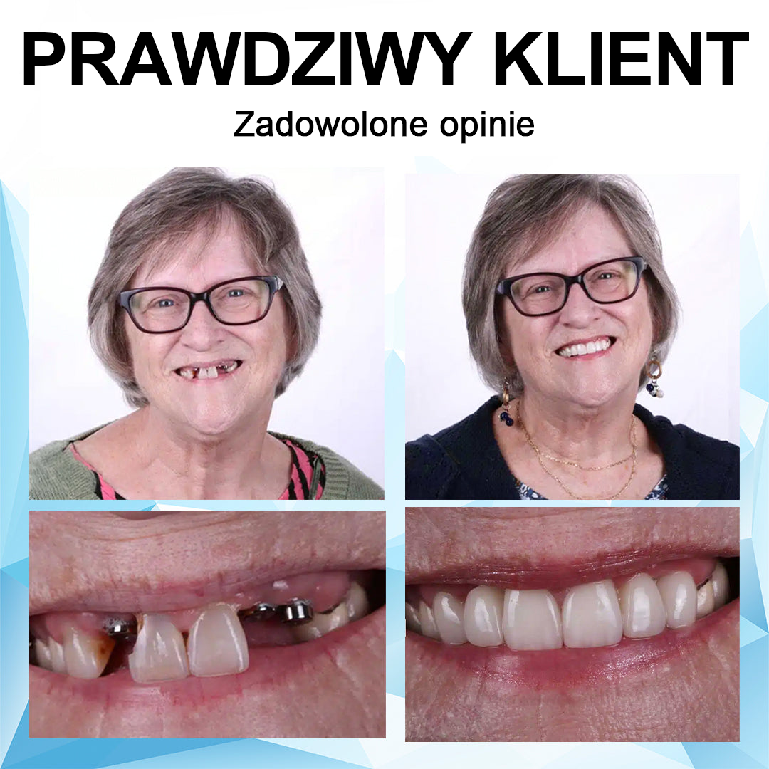 👨‍⚕🦷 Furzero™Regulowana proteza - najlepsza alternatywa dla drogich aparatów ortodontycznych!🥰