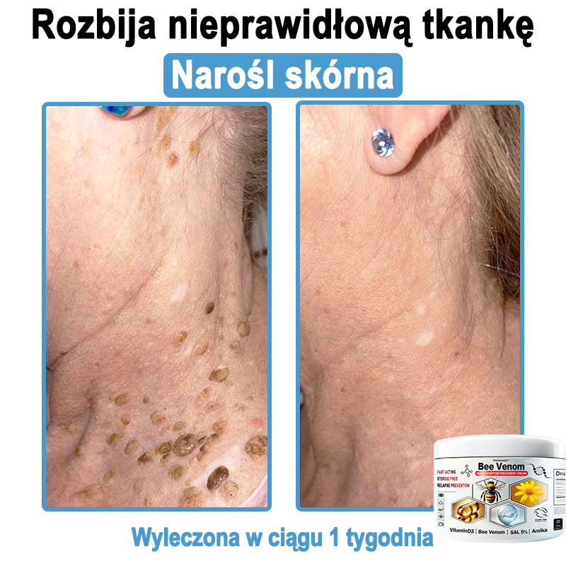 TOD𝐀HOF™🥑 Krem do wielosymptomowej pielęgnacji skóry z jadem pszczelim (ACDRECOMMENDS)