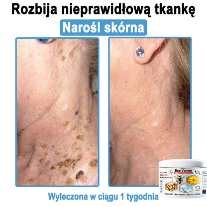 TOD𝐀HOF™🥑 Krem do wielosymptomowej pielęgnacji skóry z jadem pszczelim (ACDRECOMMENDS)