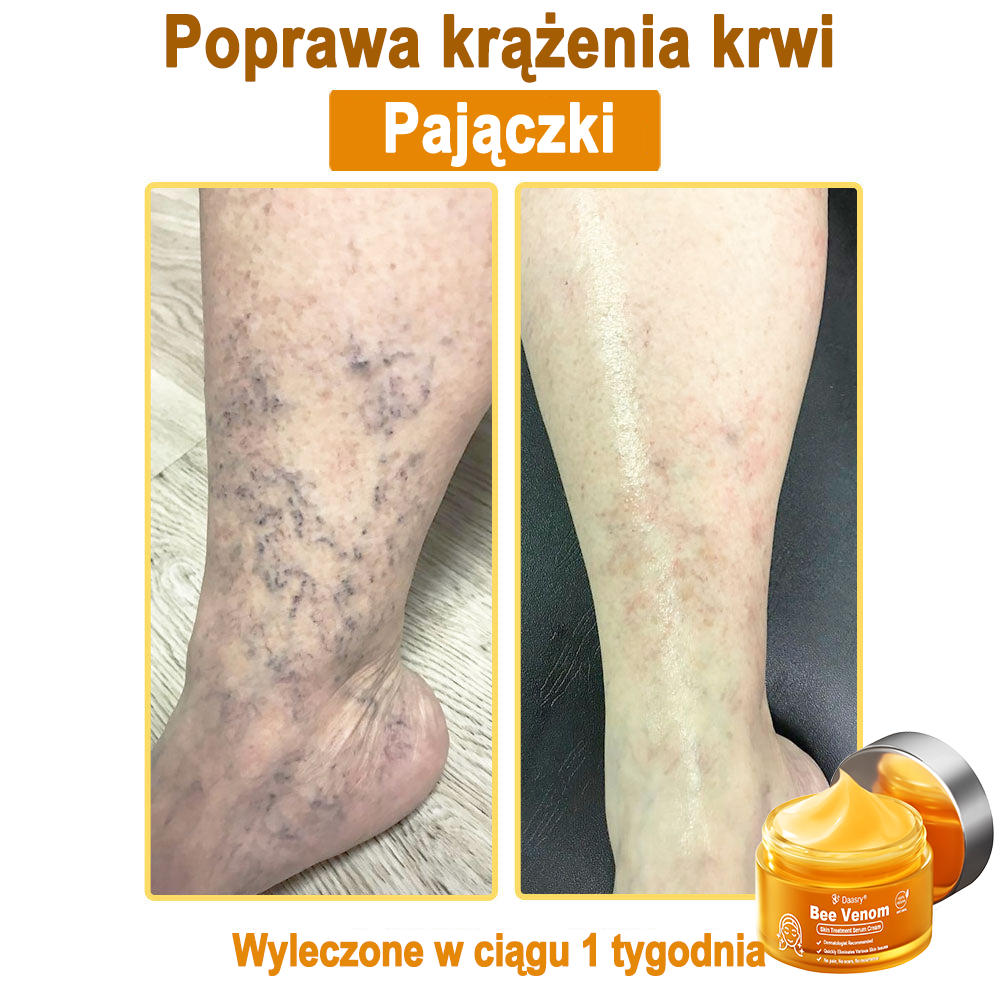 Daasry® 𝑩𝒆𝒆 𝑽𝒆𝒏𝒐𝒎 𝑺𝒌𝒊𝒏 𝑻𝒓𝒆𝒂𝒕𝒎𝒆𝒏𝒕 𝑺𝒆𝒓𝒖𝒎 𝑪𝒓𝒆𝒂𝒎👨‍⚕️ (Suitable for all ages & TGA recommends)