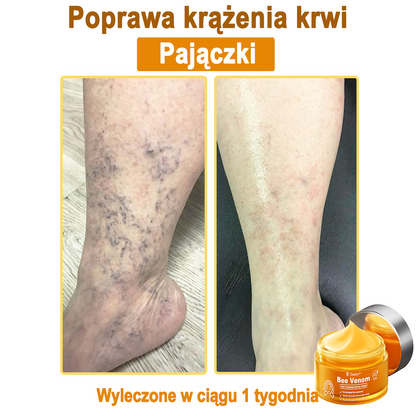 Daasry® 𝑩𝒆𝒆 𝑽𝒆𝒏𝒐𝒎 𝑺𝒌𝒊𝒏 𝑻𝒓𝒆𝒂𝒕𝒎𝒆𝒏𝒕 𝑺𝒆𝒓𝒖𝒎 𝑪𝒓𝒆𝒂𝒎👨‍⚕️ (Suitable for all ages & TGA recommends)