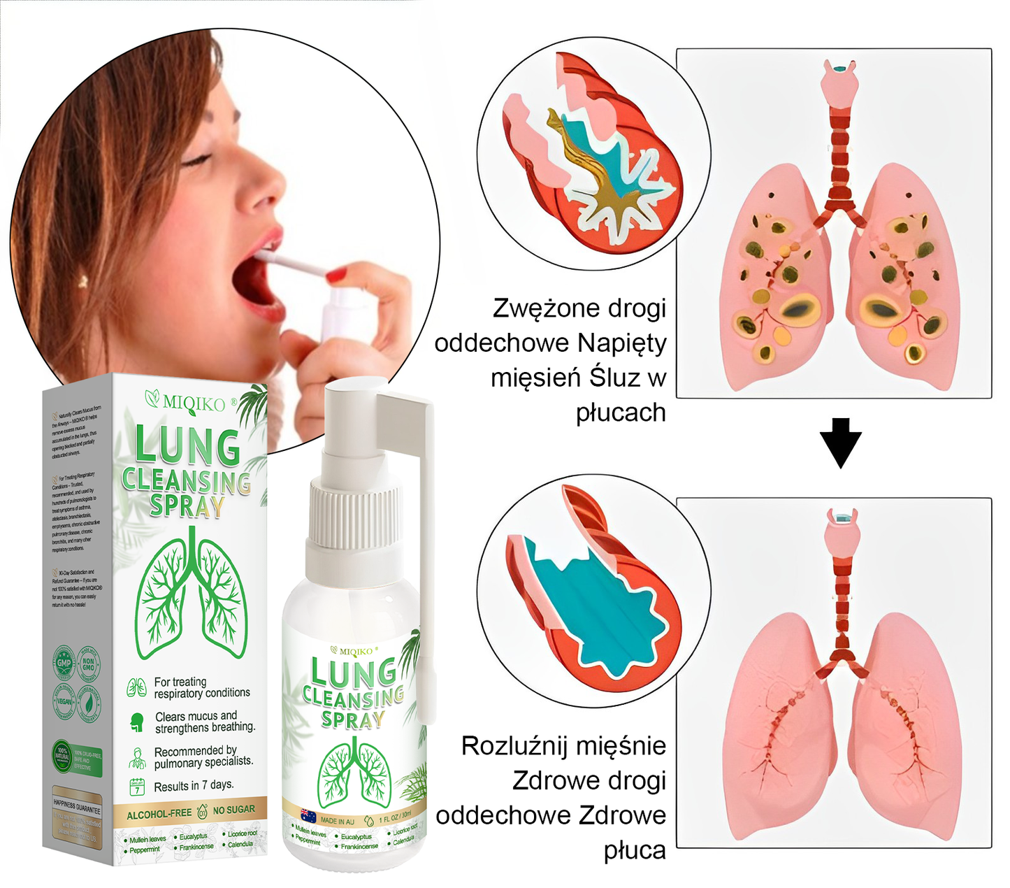 [Oficjalny flagowy sklep marki]👨‍⚕️MIQIKO® Zaawansowany spray oczyszczający płuca (☘️zalecany przez specjalistów od płuc☘️) ☘️☘️☘️