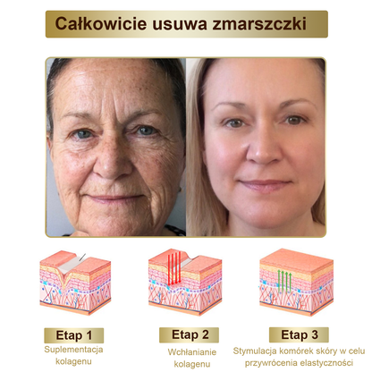 Gotówka przy odbiorze] flysmus™ Bee Venom Wart and Mole Removal Skin Cream (👨‍⚕Zalecenia AAD) 🐝🐝 (🔥Ostatni dzień promocji 70% taniej)