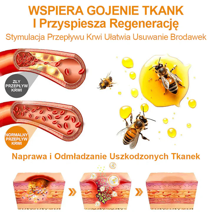 【✨Za pobraniem✨】Vsoxa™ Krem do usuwania brodawek i pieprzyków z jadem pszczelim (👨‍⚕Zalecenia AAD) 🐝🐝 (🔥Ostatni dzień wyprzedaży 70% taniej)