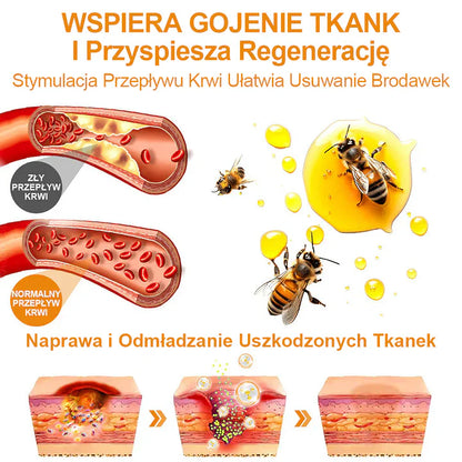 【✨Za pobraniem✨】Vsoxa™ Krem do usuwania brodawek i pieprzyków z jadem pszczelim (👨‍⚕Zalecenia AAD) 🐝🐝 (🔥Ostatni dzień wyprzedaży 70% taniej)