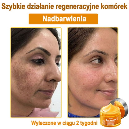 Daasry® 𝑩𝒆𝒆 𝑽𝒆𝒏𝒐𝒎 𝑺𝒌𝒊𝒏 𝑻𝒓𝒆𝒂𝒕𝒎𝒆𝒏𝒕 𝑺𝒆𝒓𝒖𝒎 𝑪𝒓𝒆𝒂𝒎👨‍⚕️ (Suitable for all ages & TGA recommends)