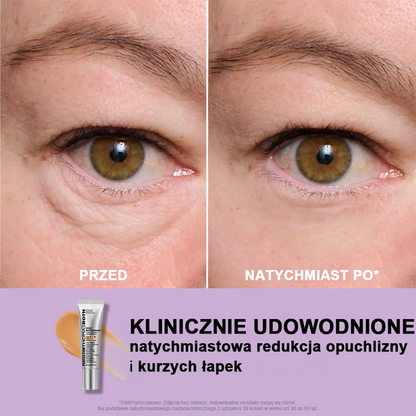 🌸Natychmiastowy Liftingujący Krem pod Oczy o Lekkiej Konsystencji – Maksymalne Ujędrnienie i Gładkie Wykończenie ✨✨