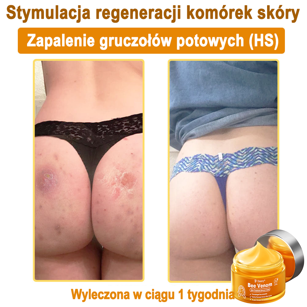 Daasry® 𝑩𝒆𝒆 𝑽𝒆𝒏𝒐𝒎 𝑺𝒌𝒊𝒏 𝑻𝒓𝒆𝒂𝒕𝒎𝒆𝒏𝒕 𝑺𝒆𝒓𝒖𝒎 𝑪𝒓𝒆𝒂𝒎👨‍⚕️ (Suitable for all ages & TGA recommends)