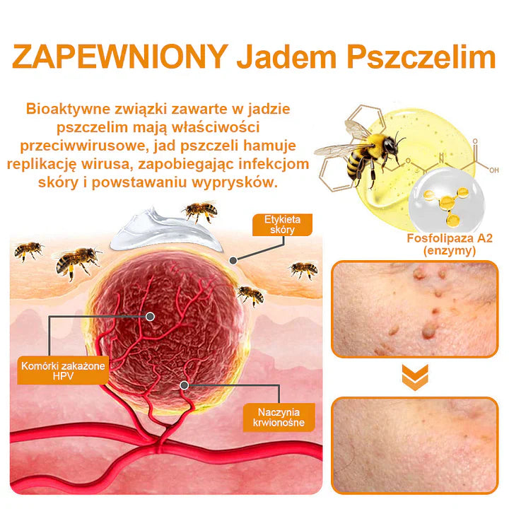 【✨Za pobraniem✨】Vsoxa™ Krem do usuwania brodawek i pieprzyków z jadem pszczelim (👨‍⚕Zalecenia AAD) 🐝🐝 (🔥Ostatni dzień wyprzedaży 70% taniej)