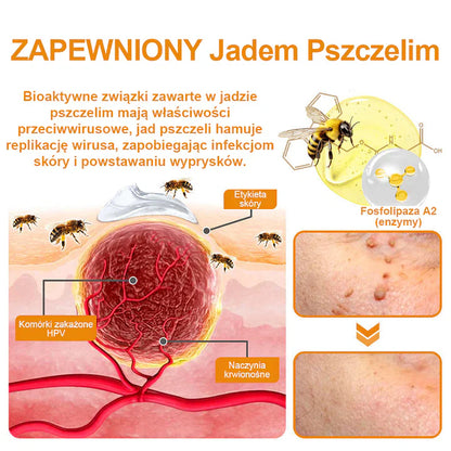 【✨Za pobraniem✨】Vsoxa™ Krem do usuwania brodawek i pieprzyków z jadem pszczelim (👨‍⚕Zalecenia AAD) 🐝🐝 (🔥Ostatni dzień wyprzedaży 70% taniej)