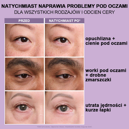 🌸Natychmiastowy Liftingujący Krem pod Oczy o Lekkiej Konsystencji – Maksymalne Ujędrnienie i Gładkie Wykończenie ✨✨