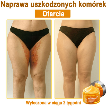 Daasry® 𝑩𝒆𝒆 𝑽𝒆𝒏𝒐𝒎 𝑺𝒌𝒊𝒏 𝑻𝒓𝒆𝒂𝒕𝒎𝒆𝒏𝒕 𝑺𝒆𝒓𝒖𝒎 𝑪𝒓𝒆𝒂𝒎👨‍⚕️ (Suitable for all ages & TGA recommends)