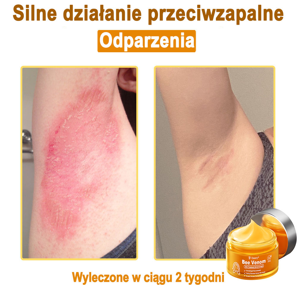 Daasry® 𝑩𝒆𝒆 𝑽𝒆𝒏𝒐𝒎 𝑺𝒌𝒊𝒏 𝑻𝒓𝒆𝒂𝒕𝒎𝒆𝒏𝒕 𝑺𝒆𝒓𝒖𝒎 𝑪𝒓𝒆𝒂𝒎👨‍⚕️ (Suitable for all ages & TGA recommends)