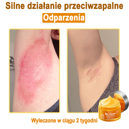 Daasry® 𝑩𝒆𝒆 𝑽𝒆𝒏𝒐𝒎 𝑺𝒌𝒊𝒏 𝑻𝒓𝒆𝒂𝒕𝒎𝒆𝒏𝒕 𝑺𝒆𝒓𝒖𝒎 𝑪𝒓𝒆𝒂𝒎👨‍⚕️ (Suitable for all ages & TGA recommends)