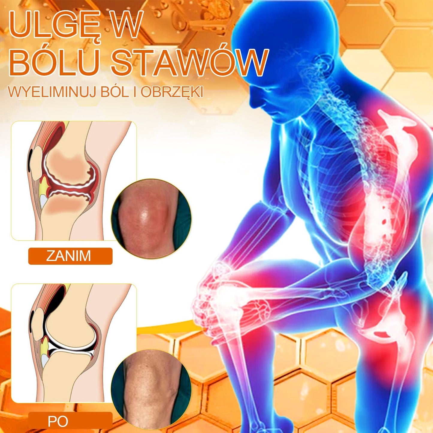 Oficjalny sklep: Aetheris™ Krem terapeutyczny z jadem pszczelim na natychmiastową, ultra silną ulgę w bólu - (Zapewnia eliminację bólu przy zapaleniu stawów, bólach mięśni, pleców, kolan, ramion, bioder, nadgarstków, dłoni)