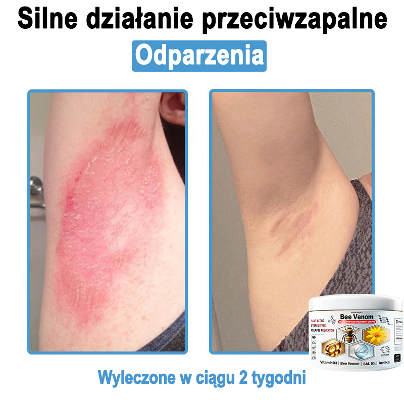 TOD𝐀HOF™🥑 Krem do wielosymptomowej pielęgnacji skóry z jadem pszczelim (ACDRECOMMENDS)